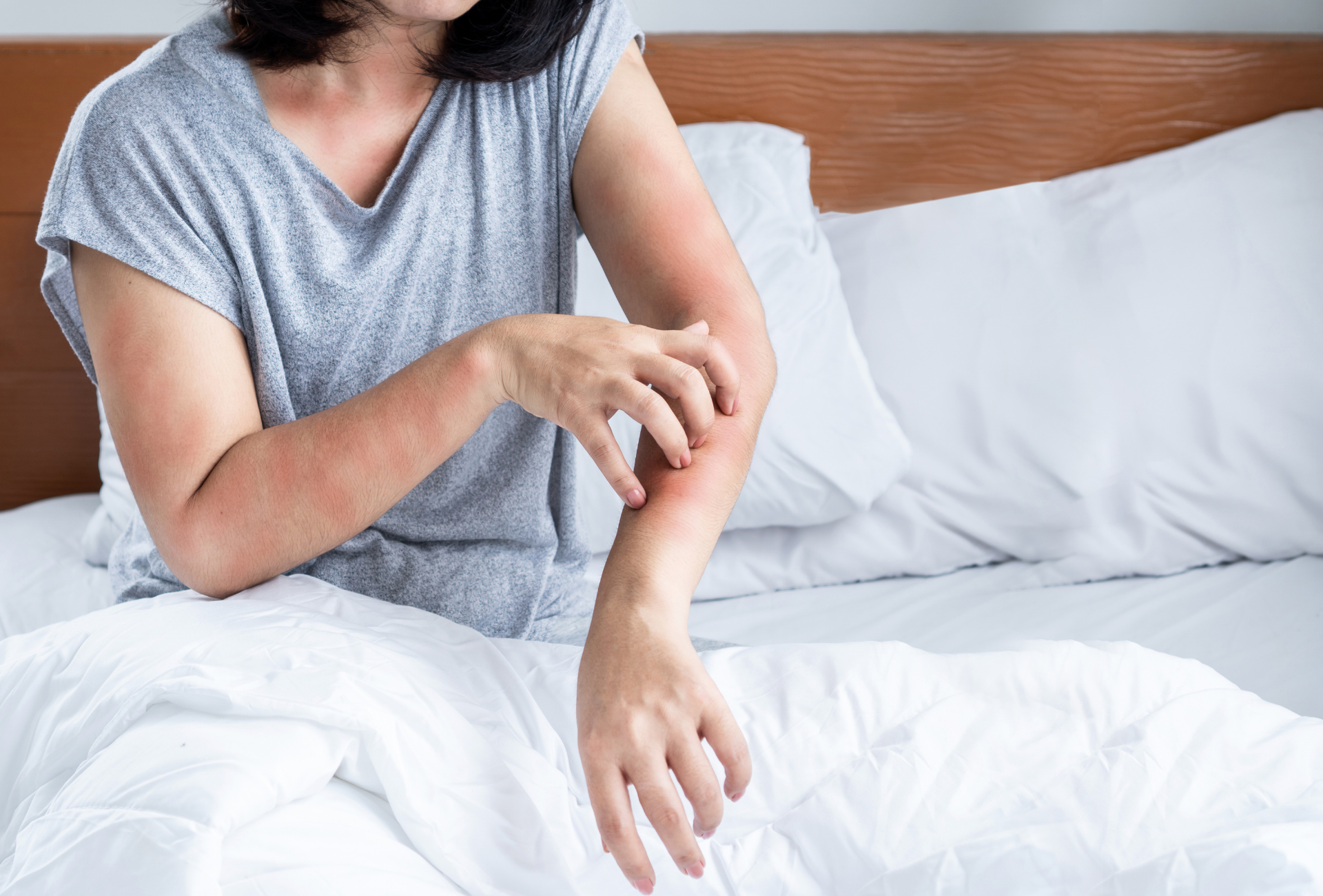 ¿Chinches en casa? Guía paso a paso para eliminarlos en Móstoles con ayuda profesional